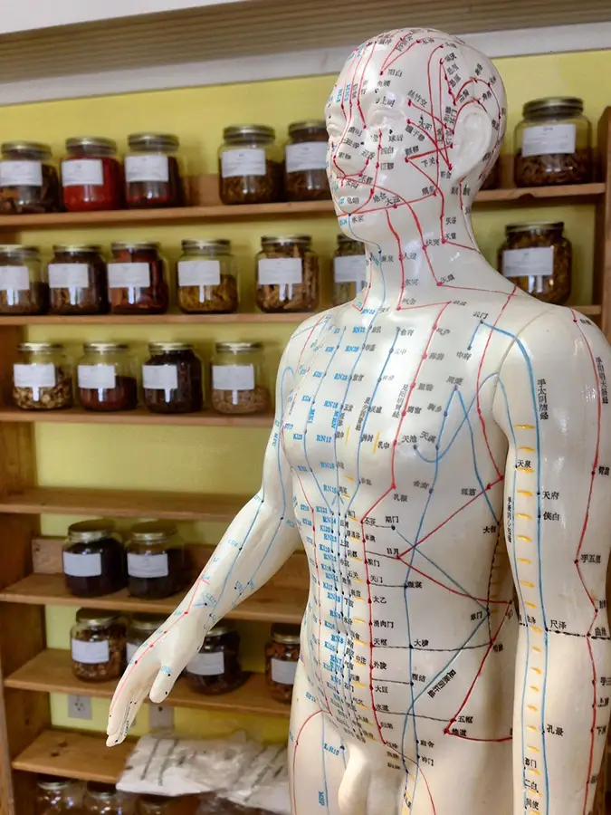 Acupuncture chinoise